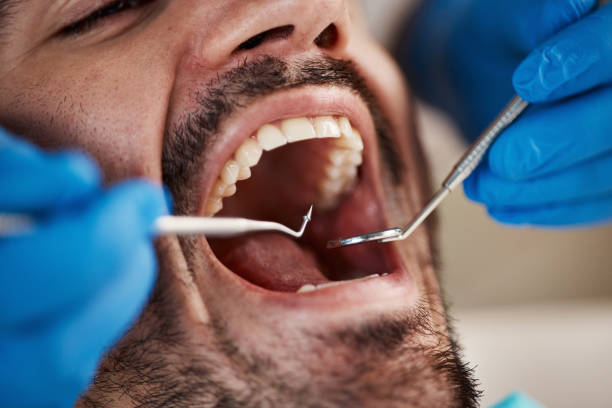 Best Emergency Dental Care for Sports Injuries in Flomaton, AL